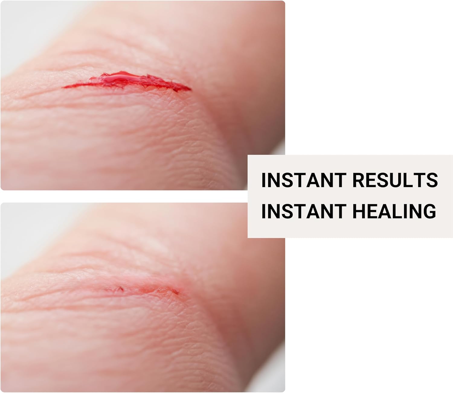 Before and after comparison of a cut on skin with text 'Instant Results Instant Healing'.