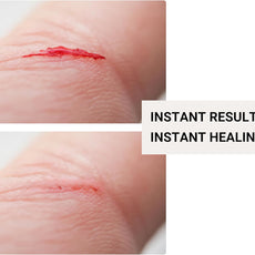 Before and after comparison of a cut on skin with text 'Instant Results Instant Healing'.